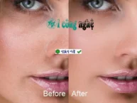 Delicious Skin 2.0 for Photoshop Plugin làm đẹp da ảnh